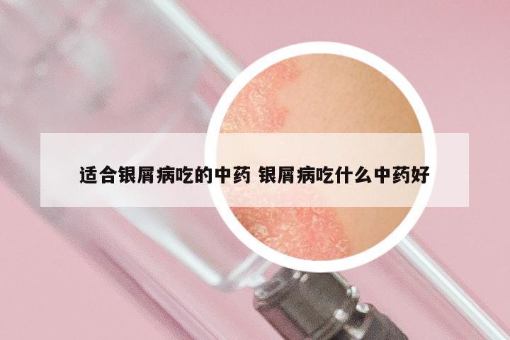 适合银屑病吃的中药 银屑病吃什么中药好