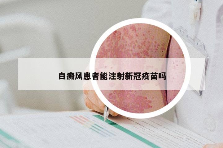 白癜风患者能注射新冠疫苗吗