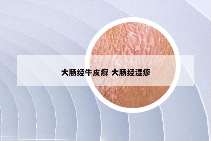 大肠经牛皮癣 大肠经湿疹