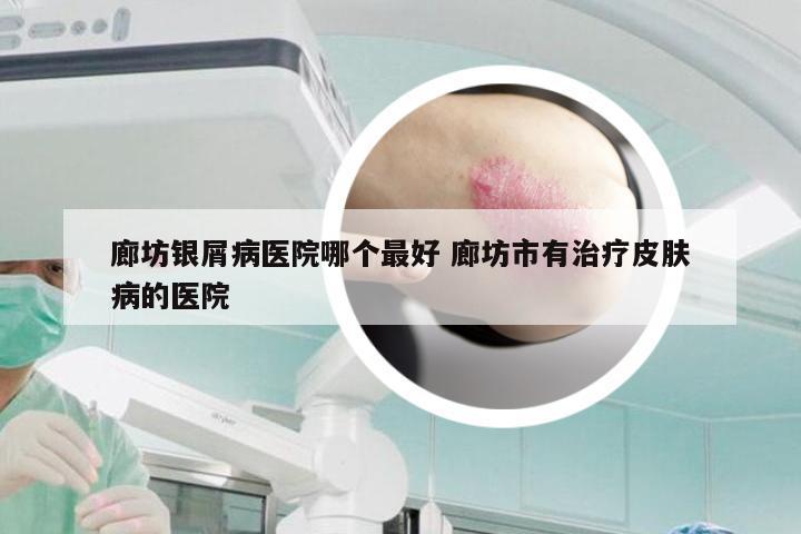 廊坊银屑病医院哪个最好 廊坊市有治疗皮肤病的医院