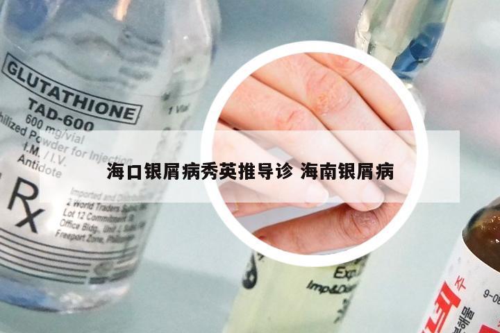 海口银屑病秀英推导诊 海南银屑病