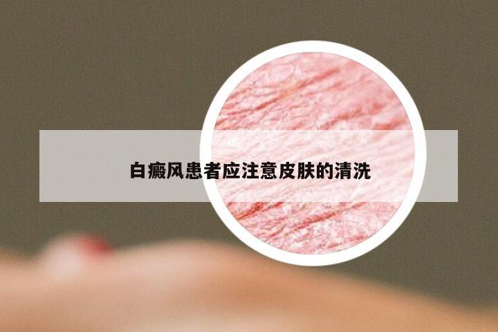 白癜风患者应注意皮肤的清洗