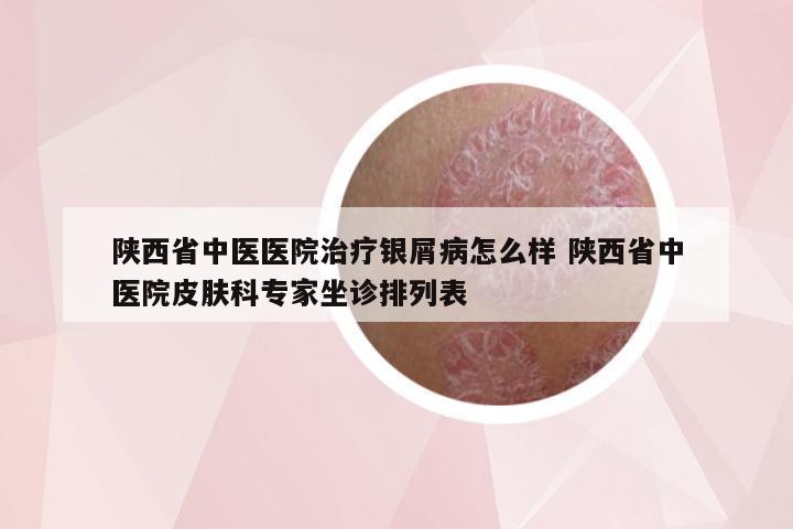 陕西省中医医院治疗银屑病怎么样 陕西省中医院皮肤科专家坐诊排列表