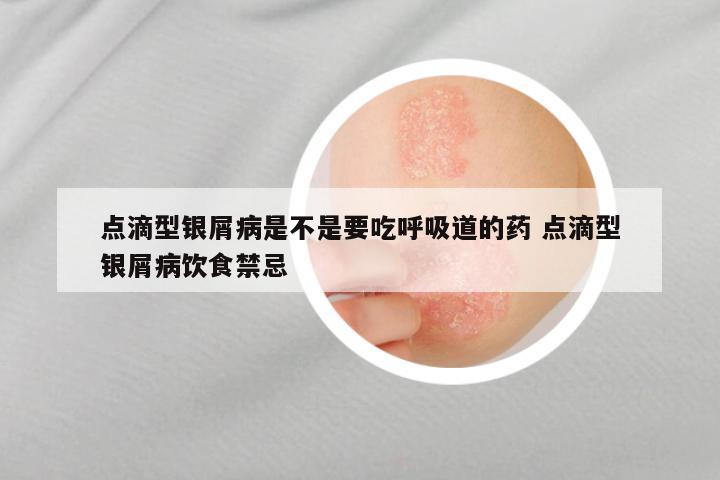 点滴型银屑病是不是要吃呼吸道的药 点滴型银屑病饮食禁忌