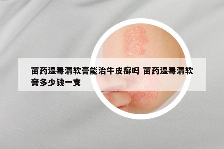 苗药湿毒清软膏能治牛皮癣吗 苗药湿毒清软膏多少钱一支