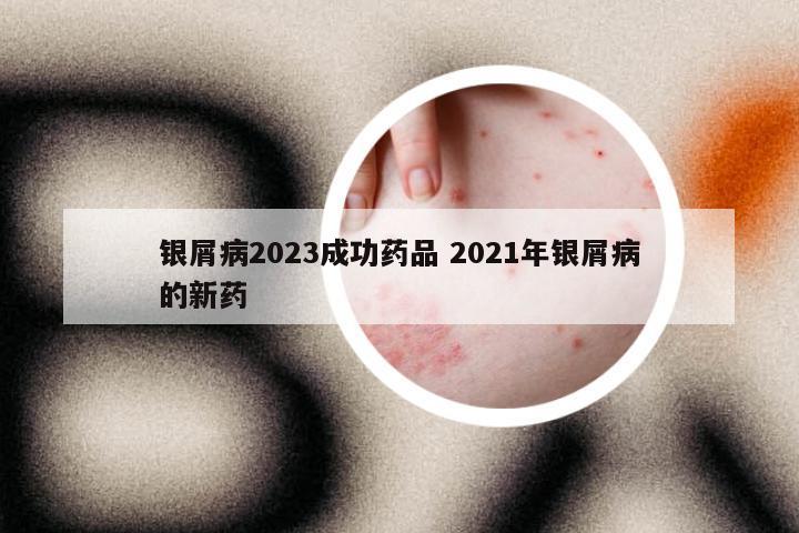 银屑病2023成功药品 2021年银屑病的新药