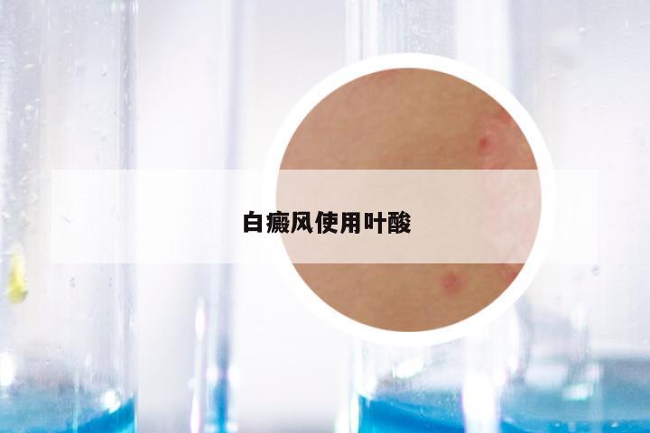 白癜风使用叶酸