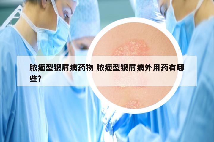 脓疱型银屑病药物 脓疱型银屑病外用药有哪些?