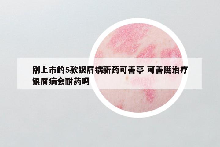 刚上市的5款银屑病新药可善亭 可善挺治疗银屑病会耐药吗