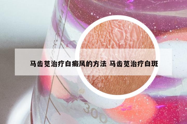 马齿苋治疗白癜风的方法 马齿苋治疗白斑
