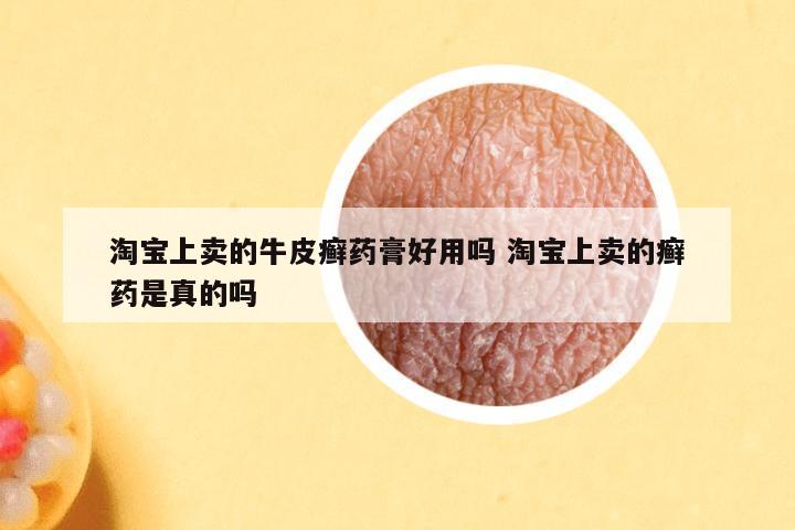 淘宝上卖的牛皮癣药膏好用吗 淘宝上卖的癣药是真的吗