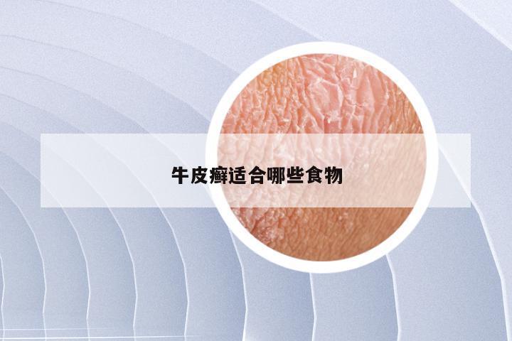 牛皮癣适合哪些食物