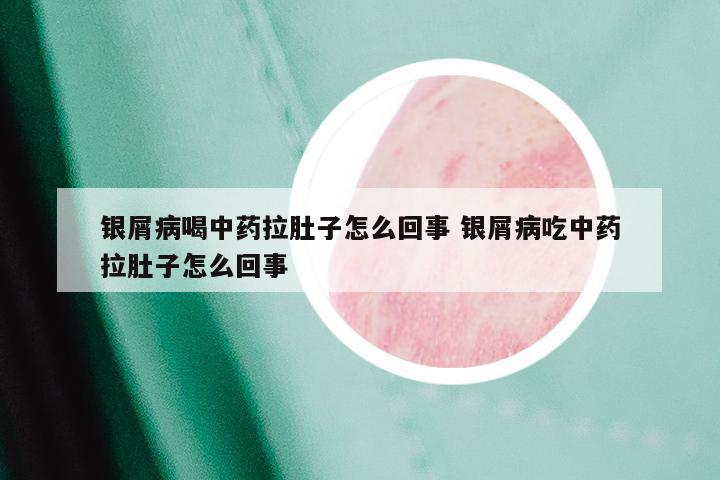 银屑病喝中药拉肚子怎么回事 银屑病吃中药拉肚子怎么回事