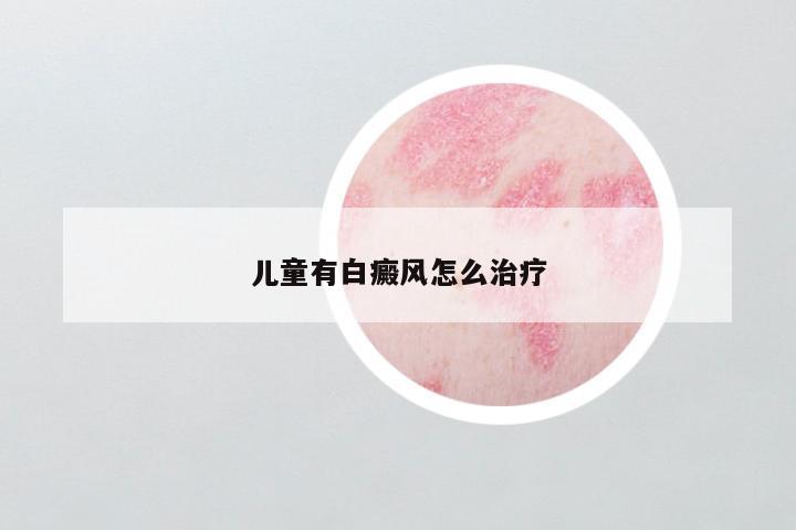 儿童有白癜风怎么治疗