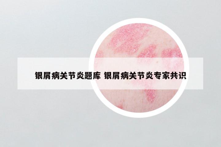 银屑病关节炎题库 银屑病关节炎专家共识