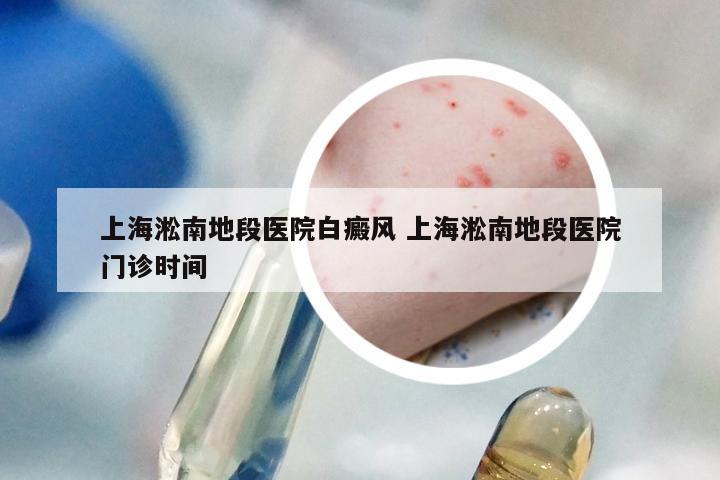 上海淞南地段医院白癜风 上海淞南地段医院门诊时间