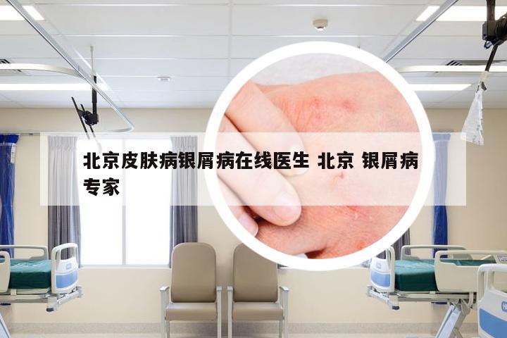 北京皮肤病银屑病在线医生 北京 银屑病 专家