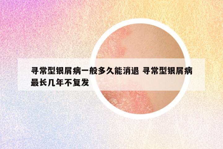 寻常型银屑病一般多久能消退 寻常型银屑病最长几年不复发