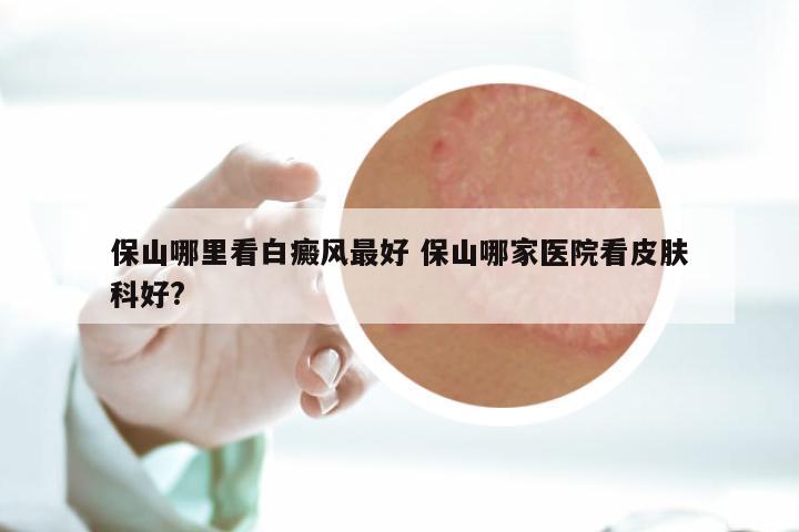 保山哪里看白癜风最好 保山哪家医院看皮肤科好?