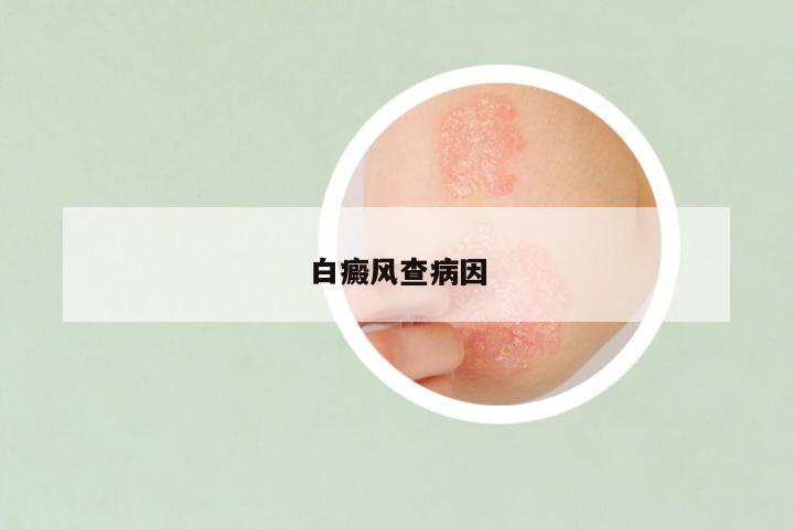 白癜风查病因