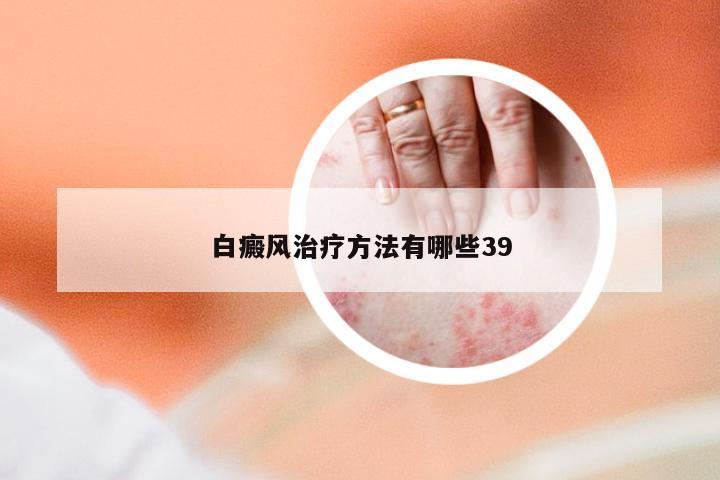 白癜风治疗方法有哪些39