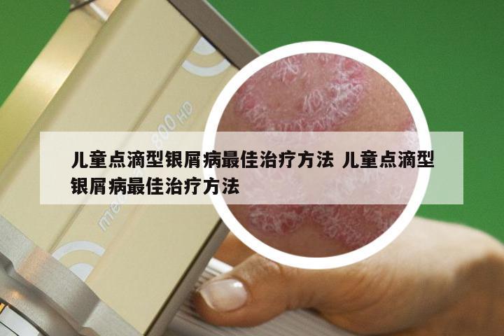 儿童点滴型银屑病最佳治疗方法 儿童点滴型银屑病最佳治疗方法