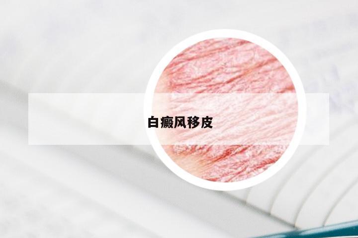 白癜风移皮