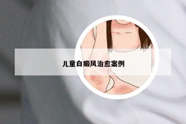 儿童白癜风治愈案例