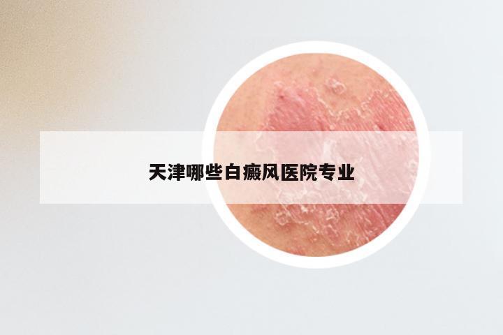 天津哪些白癜风医院专业