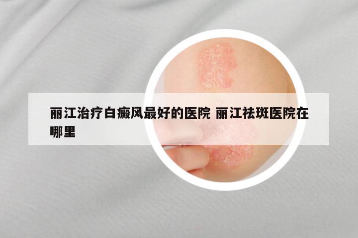 丽江治疗白癜风最好的医院 丽江祛斑医院在哪里