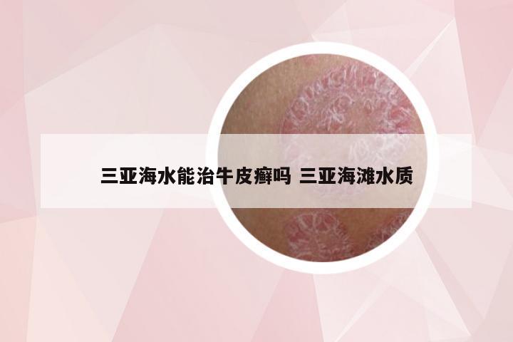 三亚海水能治牛皮癣吗 三亚海滩水质