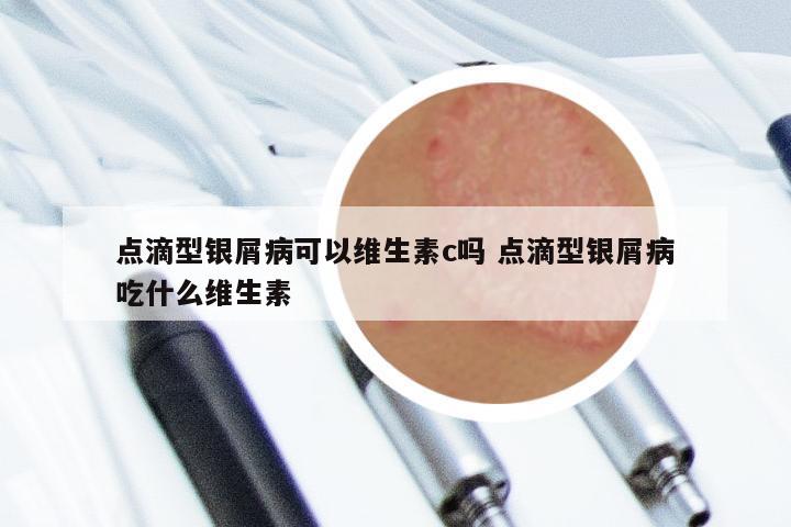 点滴型银屑病可以维生素c吗 点滴型银屑病吃什么维生素