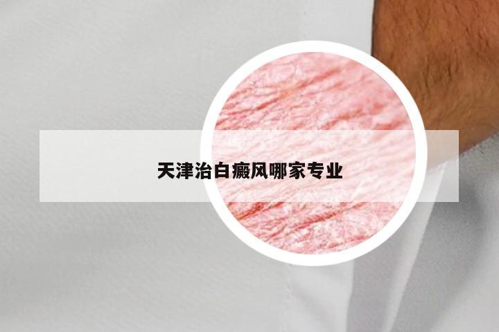 天津治白癜风哪家专业