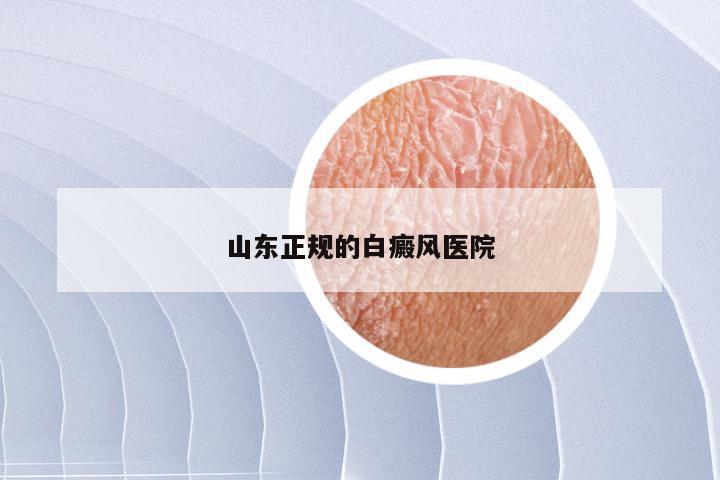 山东正规的白癜风医院