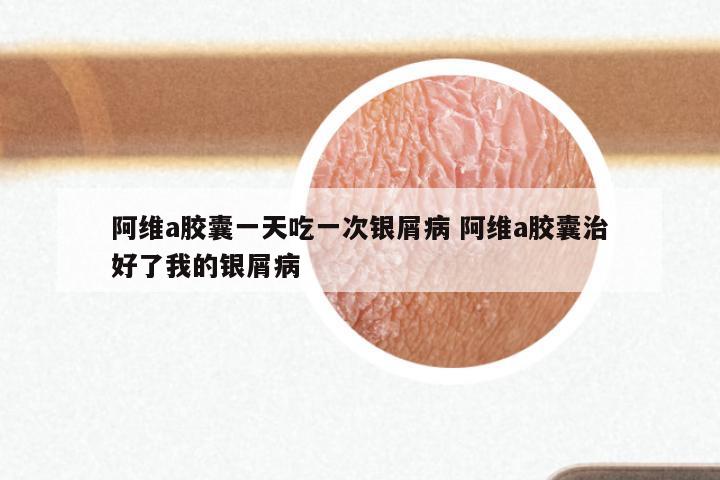 阿维a胶囊一天吃一次银屑病 阿维a胶囊治好了我的银屑病