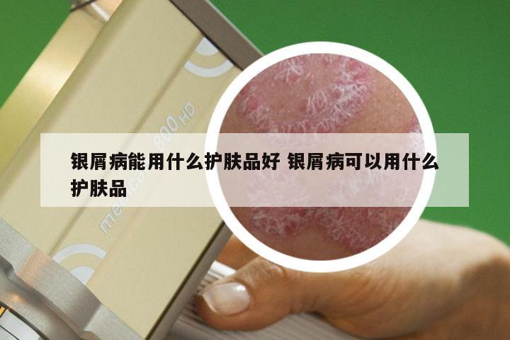 银屑病能用什么护肤品好 银屑病可以用什么护肤品