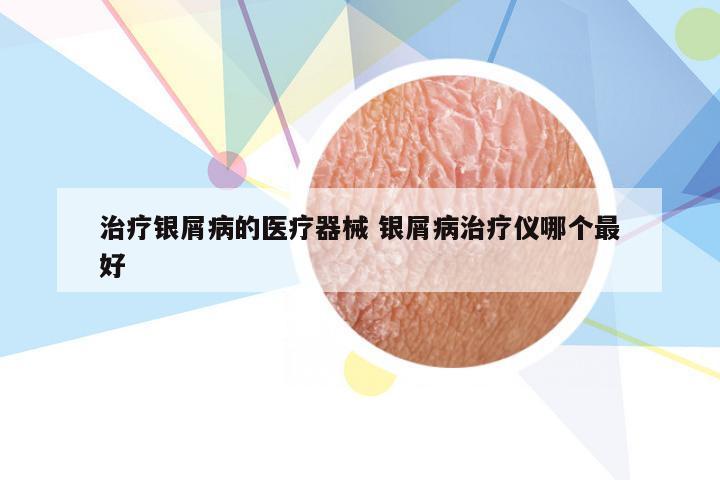 治疗银屑病的医疗器械 银屑病治疗仪哪个最好