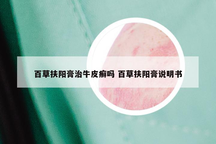 百草扶阳膏治牛皮癣吗 百草扶阳膏说明书