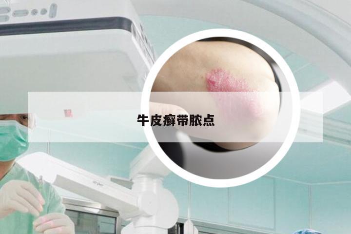 牛皮癣带脓点