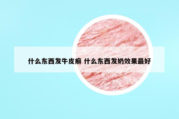 什么东西发牛皮癣 什么东西发奶效果最好