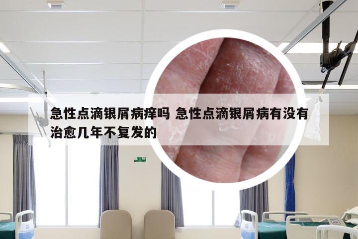 急性点滴银屑病痒吗 急性点滴银屑病有没有治愈几年不复发的