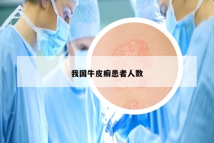 我国牛皮癣患者人数