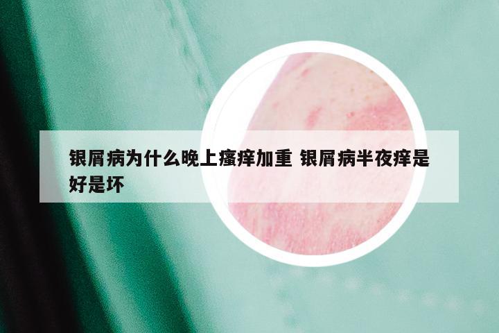 银屑病为什么晚上瘙痒加重 银屑病半夜痒是好是坏