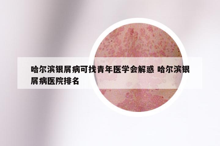 哈尔滨银屑病可找青年医学会解惑 哈尔滨银屑病医院排名
