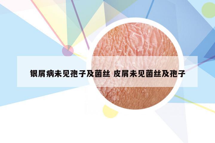 银屑病未见孢子及菌丝 皮屑未见菌丝及孢子