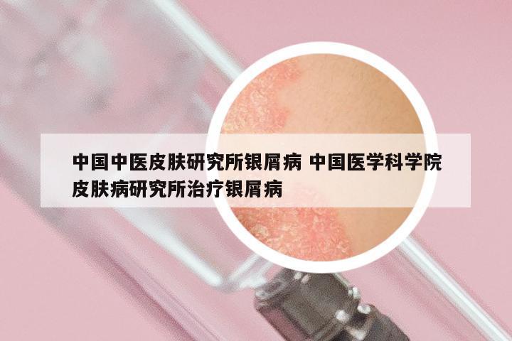 中国中医皮肤研究所银屑病 中国医学科学院皮肤病研究所治疗银屑病
