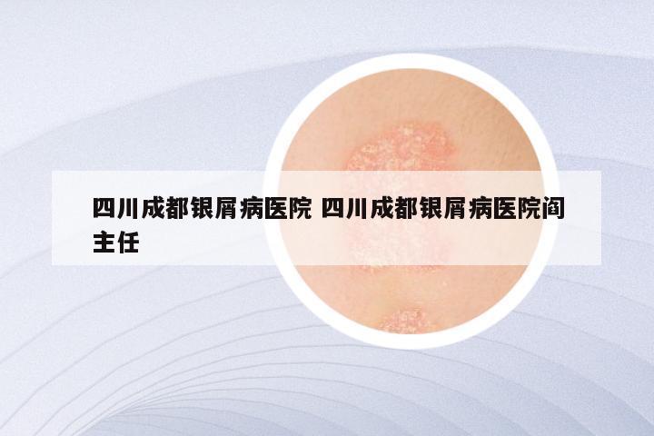 四川成都银屑病医院 四川成都银屑病医院阎主任