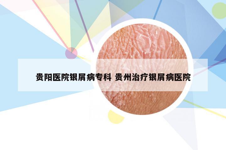 贵阳医院银屑病专科 贵州治疗银屑病医院