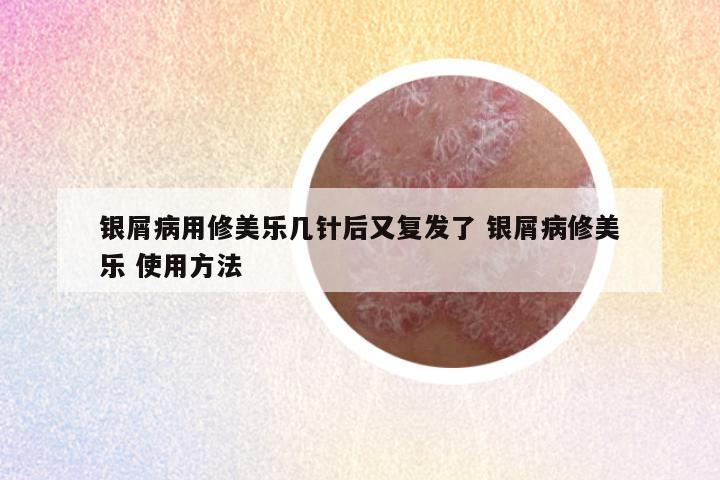 银屑病用修美乐几针后又复发了 银屑病修美乐 使用方法