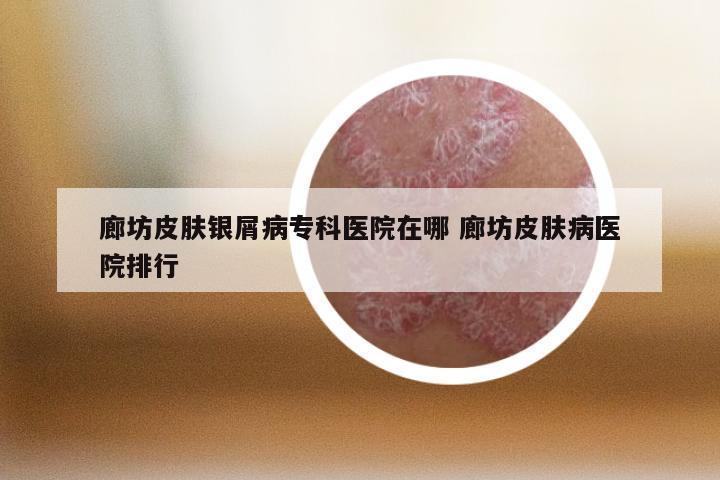 廊坊皮肤银屑病专科医院在哪 廊坊皮肤病医院排行